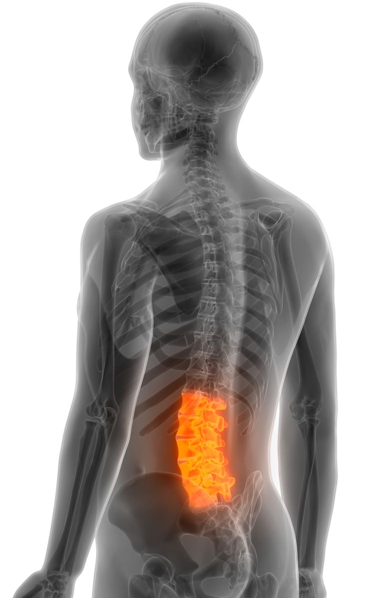 Lower back pain treatment Longueuil